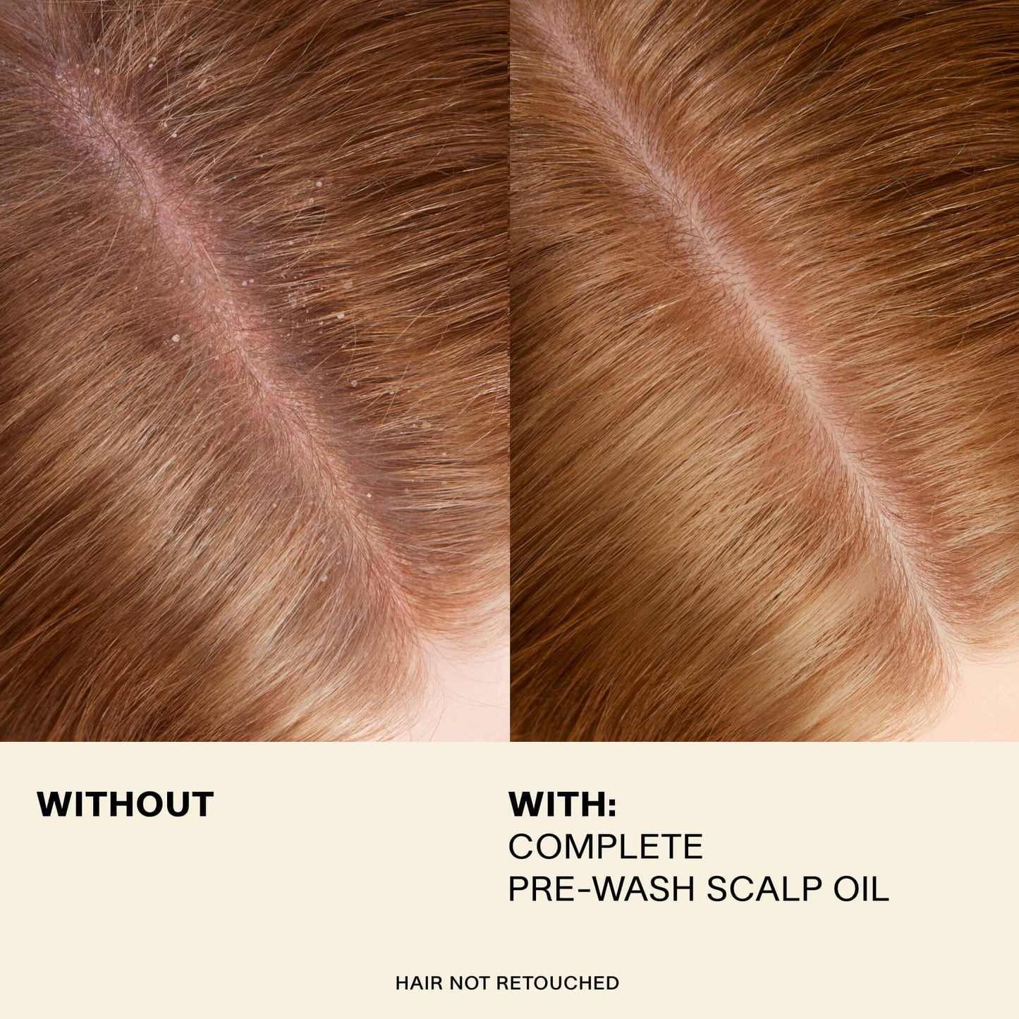 JVN Pre-Wash Scalp Oil