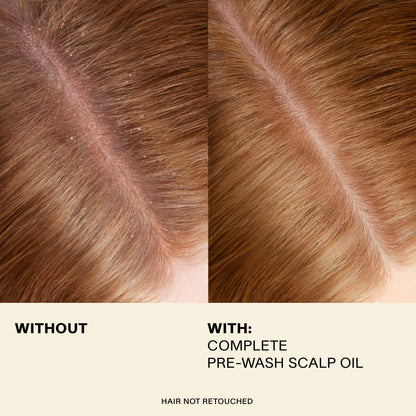 JVN Pre-Wash Scalp Oil